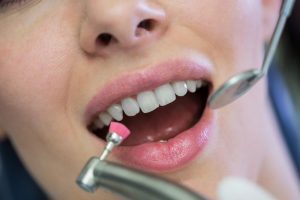 a lady is having best cosmetic treatment for her teeth
