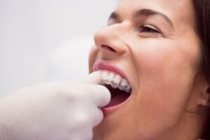 dentist putting dental bridges