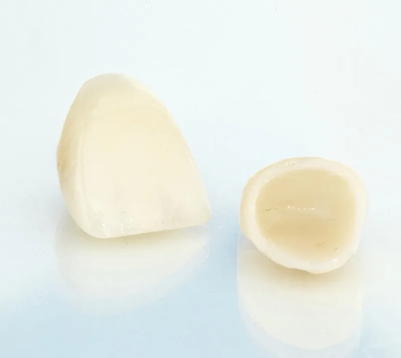 dental-crowns-near-you