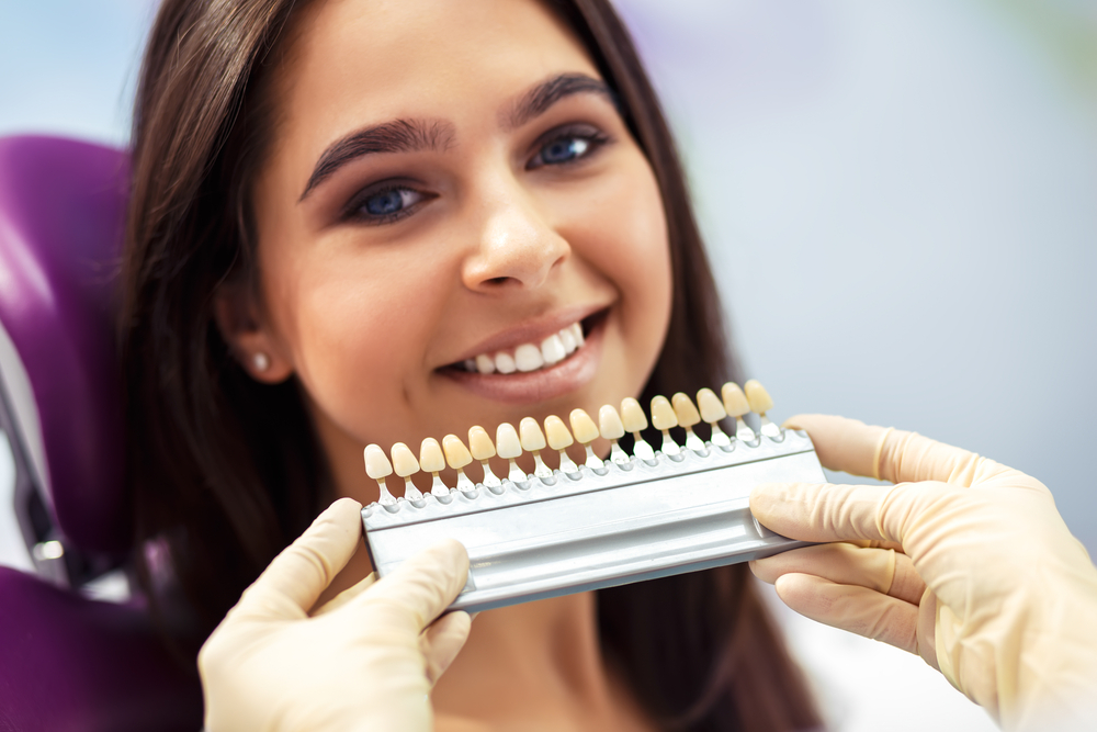 how to get your teeth 12 shades whiter