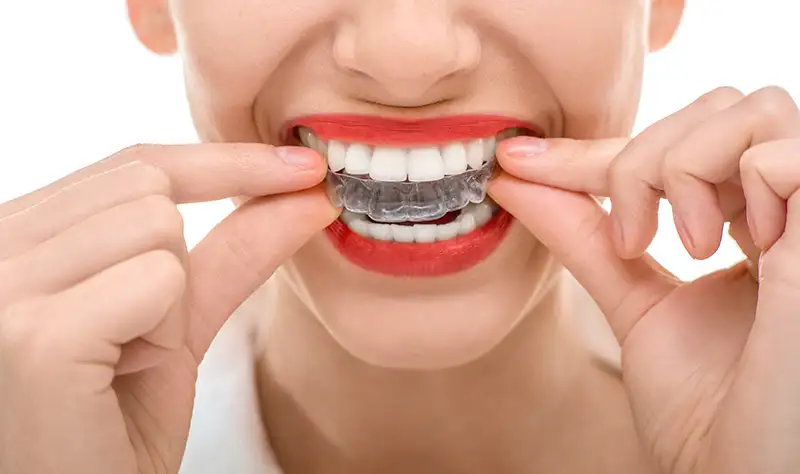 orthodontics-near-you