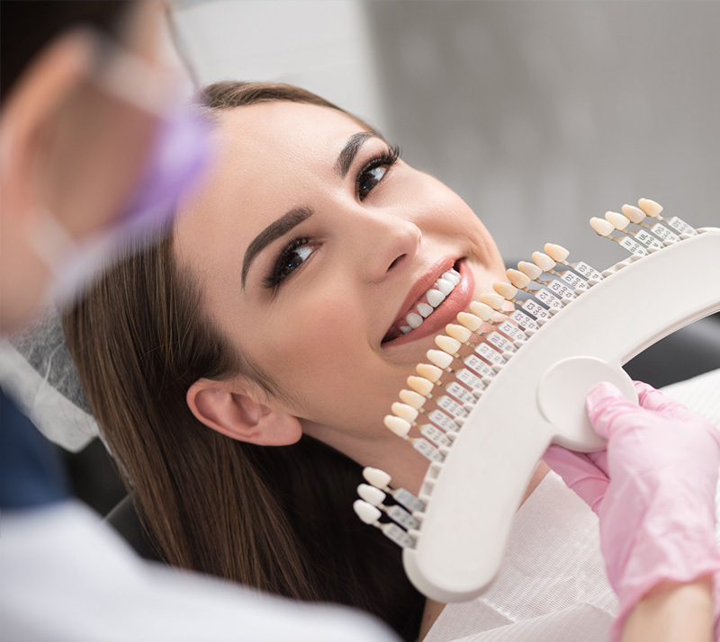 porcelain veneers in north edmonton