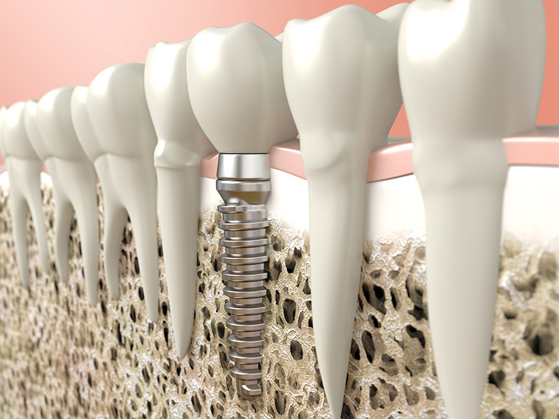 restorative dentistry near you